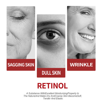 EELHOE Retinol Moisturizing Cream